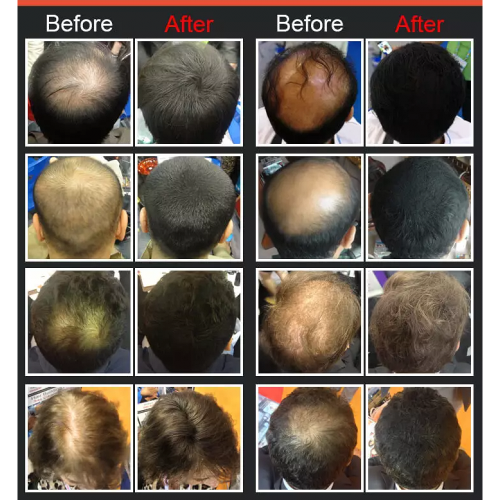 DEXE - UNISEX ΙΝΕΣ ΠΥΚΝΩΣΗΣ ΜΑΛΛΙΩΝ ΚΑΦΕ 25 GR